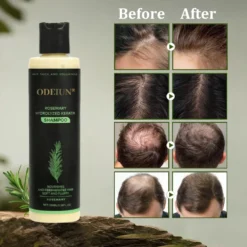 🌱 Organic Rosemary Hair Growth Shampoo